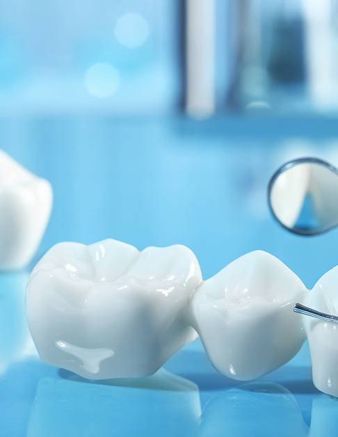 Dental bridge and implant materials against a blue background
