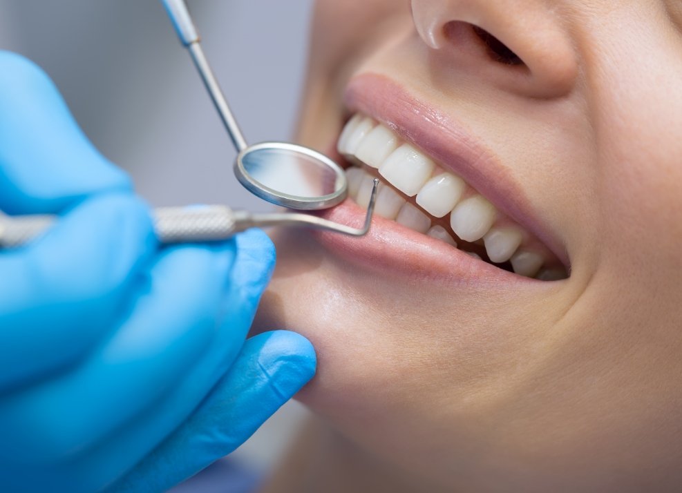 Closeup of dental patient receiving oral cancer screening