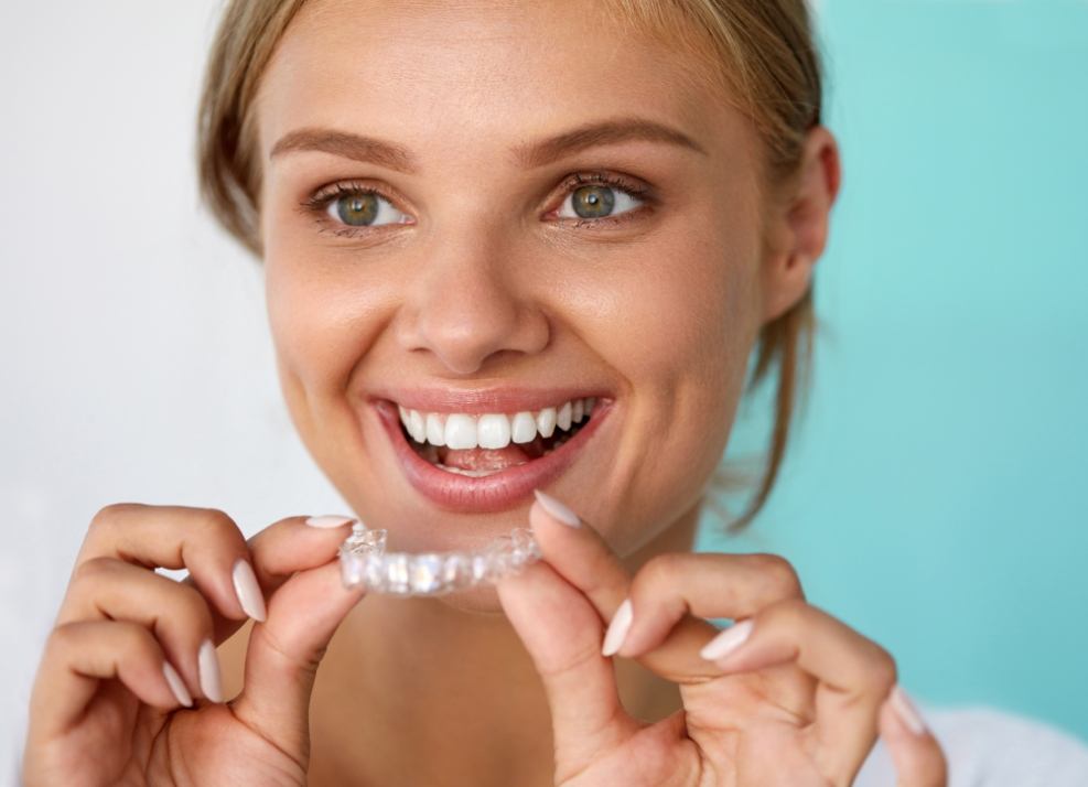 Woman using at home teeth whitening tray